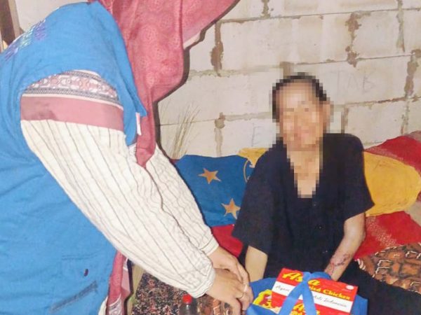 Melepuh Tangan dan Kaki, Ibu Nur dikunjungi GSJ sebagai Support
